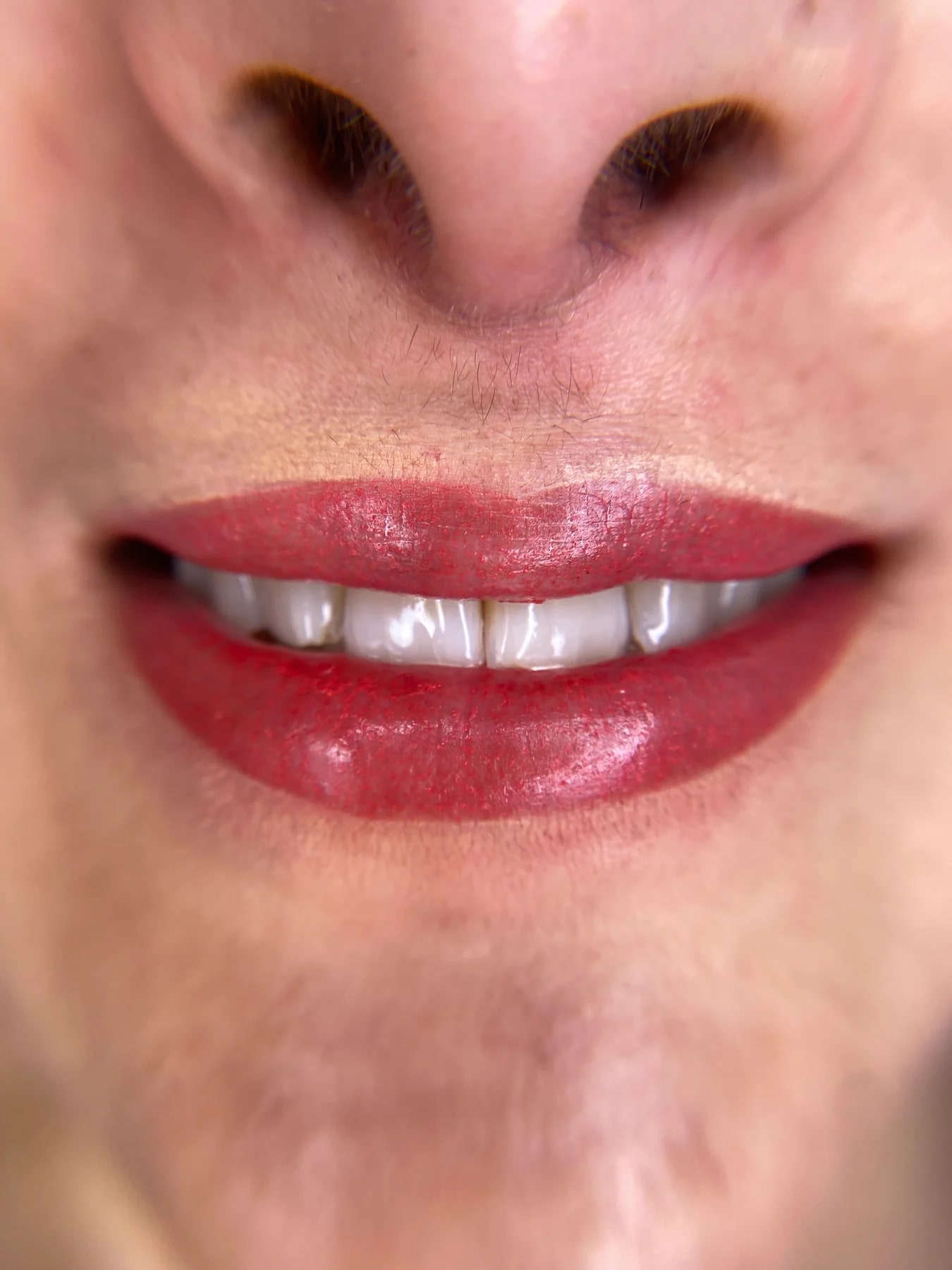 Soft permanent lip result